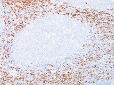 Immunohistochemistry-Paraffin: CD8 Antibody (C8/468 + C8/144B) [NBP2-34318] - Formalin-fixed paraffin-embedded human tonsil stained with CD8 Monoclonal Antibody (C8/468+C8/144)