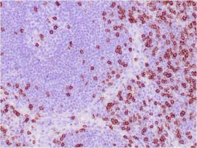 Immunohistochemistry-Paraffin: CD8 Antibody (C8/468) - IHC-Prediluted [NBP2-45323] - Formalin-fixed, paraffin-embedded human tonsil stained with CD8 Mouse Monoclonal Antibody (C8/468).