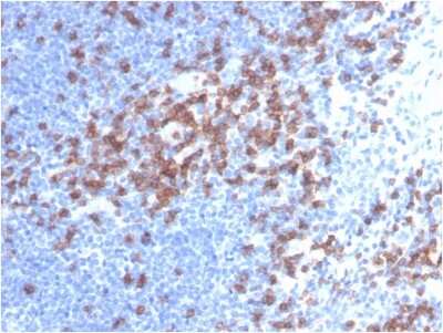 Immunohistochemistry-Paraffin: CD8 Antibody (C8/468) - IHC-Prediluted [NBP2-45323] - Formalin-fixed, paraffin-embedded human lymph node stained with CD8 Mouse Monoclonal Antibody (C8/468).