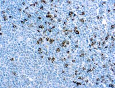 Immunohistochemistry-Paraffin: CD8 Antibody (SP16) [NBP2-26484] - Formalin fixed paraffin embedded human tonsil stained with CD8 antibody (NBP2-26484).