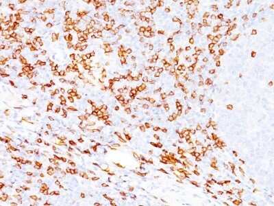 Immunohistochemistry-Paraffin: CD8 Antibody (SPM548) - Azide and BSA Free [NBP2-34790] - Formalin-fixed, paraffin-embedded human tonsil (20X) stained with CD8 Ab (SPM548). Note Cell surface staining.