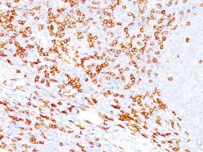 Immunohistochemistry-Paraffin: CD8 Antibody (SPM548) [NBP2-32835] - Formalin-fixed, paraffin-embedded human tonsil (20X) stained with CD8 Ab (SPM548). Note Cell surface staining.