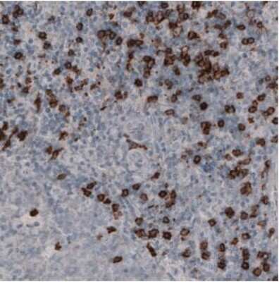 Immunohistochemistry-Paraffin: CD8 Antibody (CL1529) [NBP2-36743] - Staining of Human Tonsil shows strong immunoreactiviy of lymphoid cells outside the reaction centra.