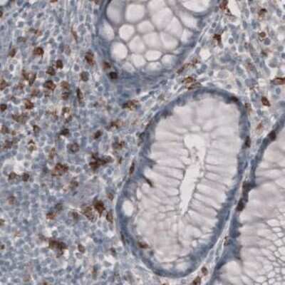 Immunohistochemistry-Paraffin: CD8 Antibody (CL1529) [NBP2-36743] - Staining of Human Rectum shows strong positivity in a subset of lymphoid cells in lamina propria.