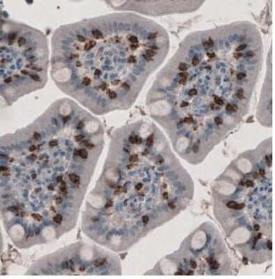 Immunohistochemistry-Paraffin: CD8 Antibody (CL1529) [NBP2-36743] -  Staining of Human small intestine shows strong immunoreactivity in a subset of lymphoid cells in lamina propria.