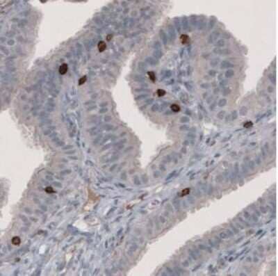 Immunohistochemistry-Paraffin: CD8 Antibody (CL1529) [NBP2-36743] - Staining of human fallopian tube shows strong positivity in a subset of lymphoid cells.