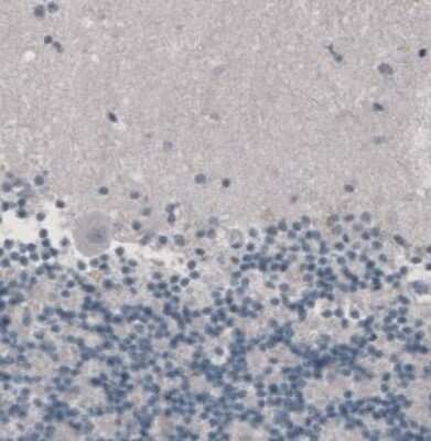 Immunohistochemistry-Paraffin: CD8 Antibody (CL1529) [NBP2-36743] -  Staining of human cerebellum shows absence of immunoreactivity.