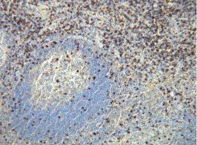 Immunohistochemistry-Paraffin: CD8 alpha Antibody (P17-V) [NBP1-79055] - CD8 expression in T-lymphocytes of the palatine tonsil. Formalin fixed, paraffin embedded human tissue (4 um section) stained with anti - CD8 monospecific clonal antibody