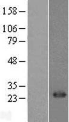 Western Blot CD8 Overexpression Lysate