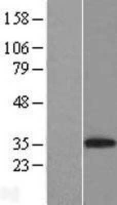 Western Blot CD8 Overexpression Lysate