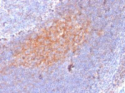 Immunohistochemistry-Paraffin: CD81 Antibody (1.3.3.22) - Azide and BSA Free [NBP2-54548] - Formalin-fixed, paraffin-embedded human Lymph Node stained with CD81 Mouse Monoclonal Antibody (1.3.3.22).