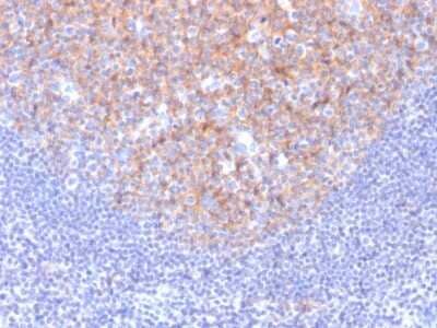 Immunohistochemistry-Paraffin: CD81 Antibody (1.3.3.22) - Azide and BSA Free [NBP2-54548] - Formalin-fixed, paraffin-embedded human Tonsil stained with CD81 Mouse Monoclonal Antibody (1.3.3.22).