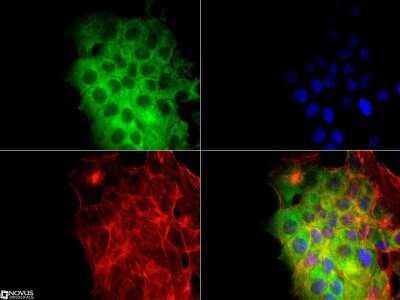 Immunocytochemistry/Immunofluorescence: CD81 Antibody (1D6) - Azide and BSA Free [NBP2-80660] - The TAPA1 Antibody (1D6) was tested in A431 cells at a 1:10 dilution against DyLight 488 (green). Actin was counterstained against Phalloidin 568 (red) and cells were mounted in DAPI Flouromount (blue). Image from the standard format of this antibody.