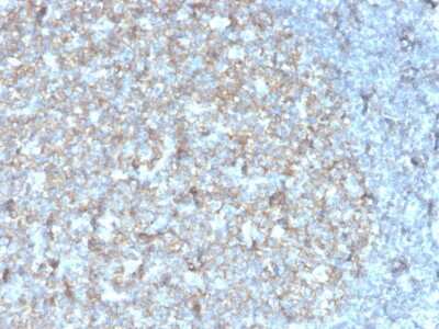 Immunohistochemistry-Paraffin: CD81 Antibody (rC81/3442) - Azide and BSA Free [NBP3-08795] - Formalin-fixed, paraffin-embedded human tonsil stained with CD81 Recombinant Mouse Monoclonal Antibody (r1.3.3.22).