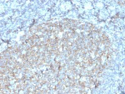 Immunohistochemistry-Paraffin: CD81 Antibody (rC81/3442) - Azide and BSA Free [NBP3-08795] - Formalin-fixed, paraffin-embedded human tonsil stained with CD81 Recombinant Mouse Monoclonal Antibody (r1.3.3.22).