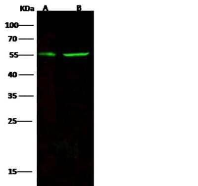 Western Blot: CD83 Antibody (104) [NBP2-89980] - Lane A: Jurkat Whole Cell LysateLane B: 293T Whole Cell LysateLysates/proteins at 30 ug per lane.SecondaryGoat Anti-Rabbit IgG H&L (Dylight800) at 1/10000 dilution.Developed using the Odyssey technique. Performed under reducing conditions.Predicted band size:23 kDaObserved band size:55 kDa