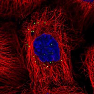 <b>Orthogonal Strategies Validation. </b>Immunocytochemistry/Immunofluorescence: CD83 Antibody [NBP2-38485] - Staining of human cell line A-431 shows localization to vesicles. Antibody staining is shown in green. 
