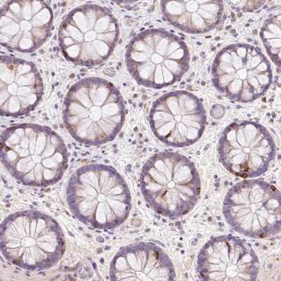 Immunohistochemistry-Paraffin: CD83 Antibody [NBP2-38485] - Staining of human colon shows moderate positivity in nuclear membrane in lymphoid cells.