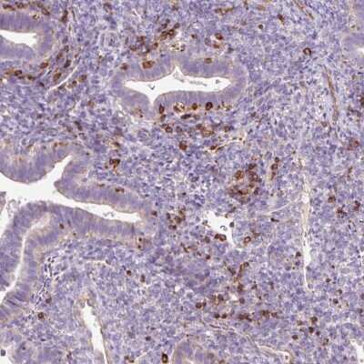 Immunohistochemistry-Paraffin: CD83 Antibody [NBP2-38485] - Staining of human endometrium shows moderate positivity in nuclear membrane in lymphoid cells.