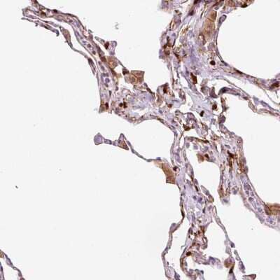 Immunohistochemistry-Paraffin: CD83 Antibody [NBP2-38485] - Staining of human lung shows moderate membranous positivity in macrophages.