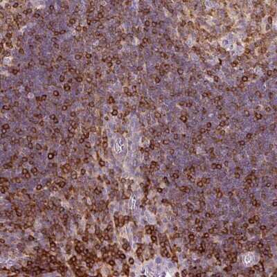 Immunohistochemistry-Paraffin: CD83 Antibody [NBP2-38485] - Staining of human tonsil shows moderate positivity in nuclear membrane in lymphoid cells.
