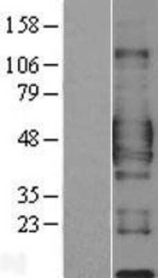 Western Blot: CD84 Overexpression Lysate (Adult Normal) [NBL1-08977] Left-Empty vector transfected control cell lysate (HEK293 cell lysate); Right -Over-expression Lysate for CD84.