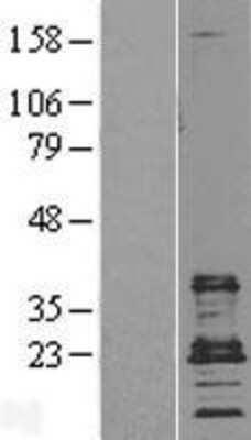 Western Blot CD9 Overexpression Lysate