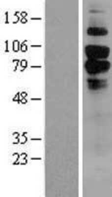 Western Blot: C1qR1/CD93 Overexpression Lysate [NBL1-08983] -  Left-Empty vector transfected control cell lysate (HEK293 cell lysate); Right -Over-expression Lysate for CD93.