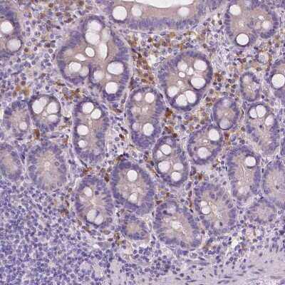 Immunohistochemistry-Paraffin: CD96 Antibody [NBP2-49491] - Staining of human small intestine shows moderate cytoplasmic positivity in lymphoid cells.
