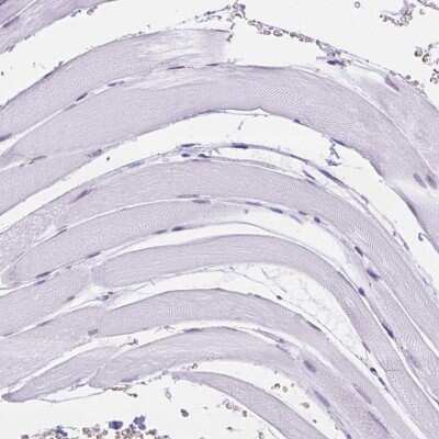 <b>Orthogonal Strategies Validation. </b>Immunohistochemistry-Paraffin: CD96 Antibody [NBP2-49491] - Staining of human skeletal muscle shows no positivity in myocytes as expected.