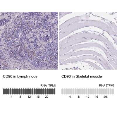 Immunohistochemistry-Paraffin: CD96 Antibody [NBP2-49491] - Staining in human lymph node and skeletal muscle tissues . Corresponding CD96 RNA-seq data are presented for the same tissues.