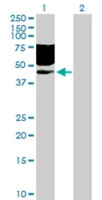 Western Blot: CD96 Antibody [H00010225-D01P] - Analysis of CD96 expression in transfected 293T cell line by CD96 polyclonal antibody.Lane 1: CD96 transfected lysate(45.60 KDa).Lane 2: Non-transfected lysate.