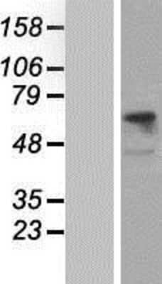 Western Blot: CD98 Overexpression Lysate (Adult Normal) [NBP2-11015] Left-Empty vector transfected control cell lysate (HEK293 cell lysate); Right -Over-expression Lysate for CD98.