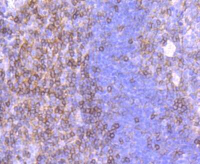 Immunohistochemistry-Paraffin: CD99 Antibody (JF0991) [NBP2-67019] - Analysis of paraffin-embedded human tonsil tissue using anti-CD99 antibody. Counter stained with hematoxylin.