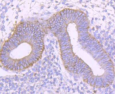 Immunohistochemistry-Paraffin: CD99 Antibody (JF0991) [NBP2-67019] - Analysis of paraffin-embedded human uterus tissue using anti-CD99 antibody. Counter stained with hematoxylin.