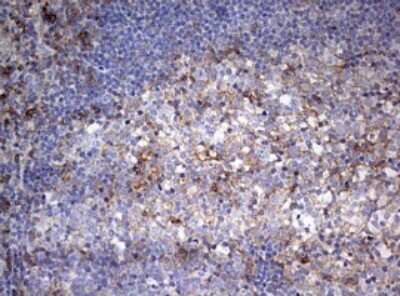 Immunohistochemistry: CD99 Antibody (OTI1D5) - Azide and BSA Free [NBP2-71197] - Analysis of Human tonsil tissue. (Heat-induced epitope retrieval by 10mM citric buffer, pH6.0, 120C for 3min)