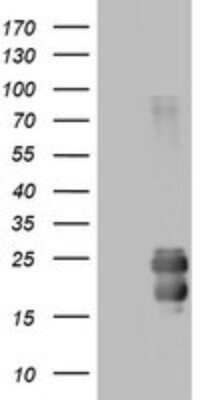 Western Blot: CD99 Antibody (OTI1D5) - Azide and BSA Free [NBP2-71197] - Analysis of HEK293T cells were transfected with the pCMV6-ENTRY control (Left lane) or pCMV6-ENTRY CD99.