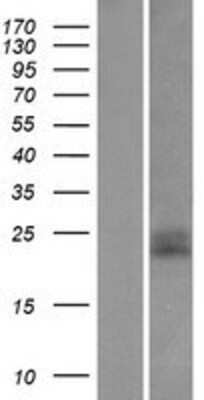 Western Blot: CD99 Overexpression Lysate (Adult Normal) [NBP2-04225] Left-Empty vector transfected control cell lysate (HEK293 cell lysate); Right -Over-expression Lysate for CD99.