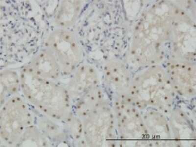 Immunohistochemistry-Paraffin: CDADC1 Antibody (1A2) [H00081602-M01] - Analysis of monoclonal antibody to CDADC1 on formalin-fixed paraffin-embedded human kidney. Antibody concentration 1 ug/ml.