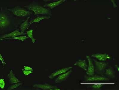 Immunocytochemistry/Immunofluorescence: CDADC1 Antibody [H00081602-B01P] - Analysis of purified antibody to CDADC1 on HeLa cell. (antibody concentration 30 ug/ml)