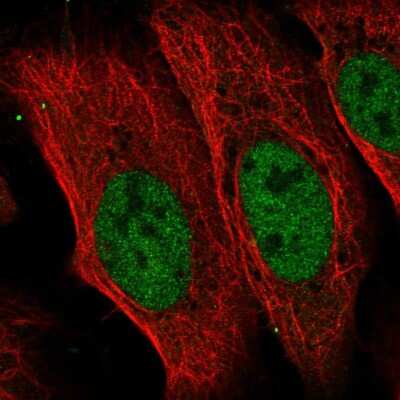 Immunocytochemistry/Immunofluorescence: CDADC1 Antibody [NBP2-55703] - Staining of human cell line U-2 OS shows localization to nucleoplasm.