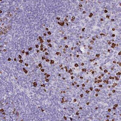 Immunohistochemistry-Paraffin: CDADC1 Antibody [NBP2-34108] - Staining of human tonsil shows strong cytoplasmic positivity in subset of germinal and non-germinal center cells.
