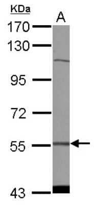 Western Blot: CDADC1 Antibody [NBP2-14906] - Sample (30 ug of whole cell lysate) A: NT2D1 7.5% SDS PAGE; antibody diluted at 1:1000.