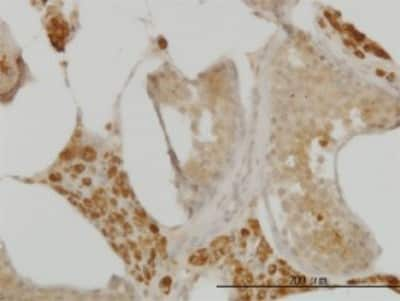 Immunohistochemistry-Paraffin: CDC123 Antibody (4B9) [H00008872-M08] - Analysis of monoclonal antibody to C10orf7 on formalin-fixed paraffin-embedded human testis. Antibody concentration 3 ug/ml