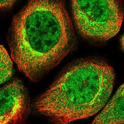 Immunocytochemistry/Immunofluorescence: CDC123 Antibody [NBP1-88540] - Immunofluorescent staining of human cell line A-431 shows localization to nucleoplasm, cytosol & the Golgi apparatus.