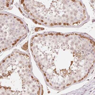 Immunocytochemistry/Immunofluorescence: CDC123 Antibody [NBP2-68733] - Immunohistochemical staining of human testis shows moderate cytoplasmic and nuclear positivity in Leydig cells and a subset of cells in seminiferous ducts were strongly stained.