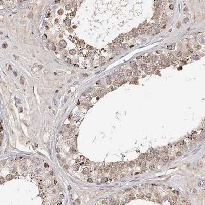 Immunohistochemistry-Paraffin: CDC123 Antibody [NBP1-88540] - Staining of human testis shows granular cytoplasmic positivity in cells in seminiferus ducts and leydig cells.