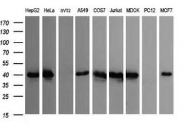 Western Blot: CDC123 Antibody (OTI1F8) - Azide and BSA Free [NBP2-71391] - Analysis of extracts (35ug) from 9 different cell lines (HepG2: human; HeLa: human; SVT2: mouse; A549: human; COS7: monkey; Jurkat: human; MDCK: canine; PC12: rat; MCF7: human).