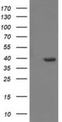 Western Blot: CDC123 Antibody (OTI1F8) - Azide and BSA Free [NBP2-71391] - Analysis of HEK293T cells were transfected with the pCMV6-ENTRY control (Left lane) or pCMV6-ENTRY CDC123.