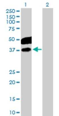 Western Blot: CDC123 Antibody [H00008872-D01P] - Analysis of CDC123 expression in transfected 293T cell line by CDC123 polyclonal antibody.Lane 1: CDC123 transfected lysate(39.10 KDa).Lane 2: Non-transfected lysate.